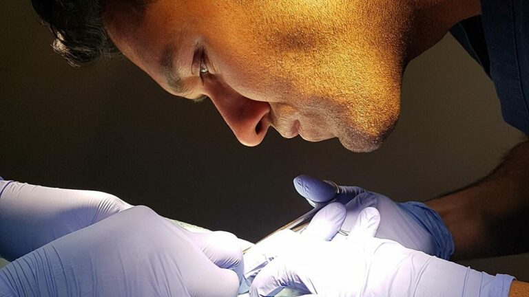 Doctor sharma performing hair transplant FUE procedure