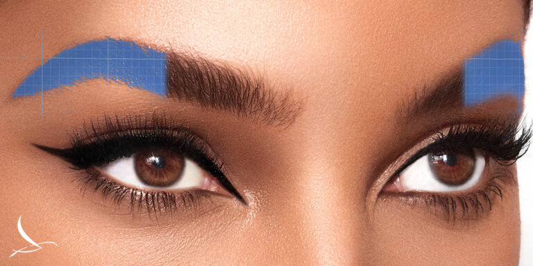 Eyebrow hair transplant edmonton2