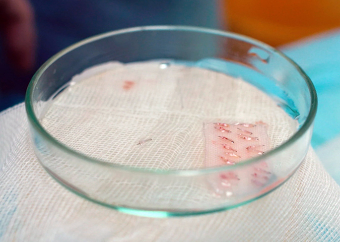 Hair follicles in petri dish storage 2