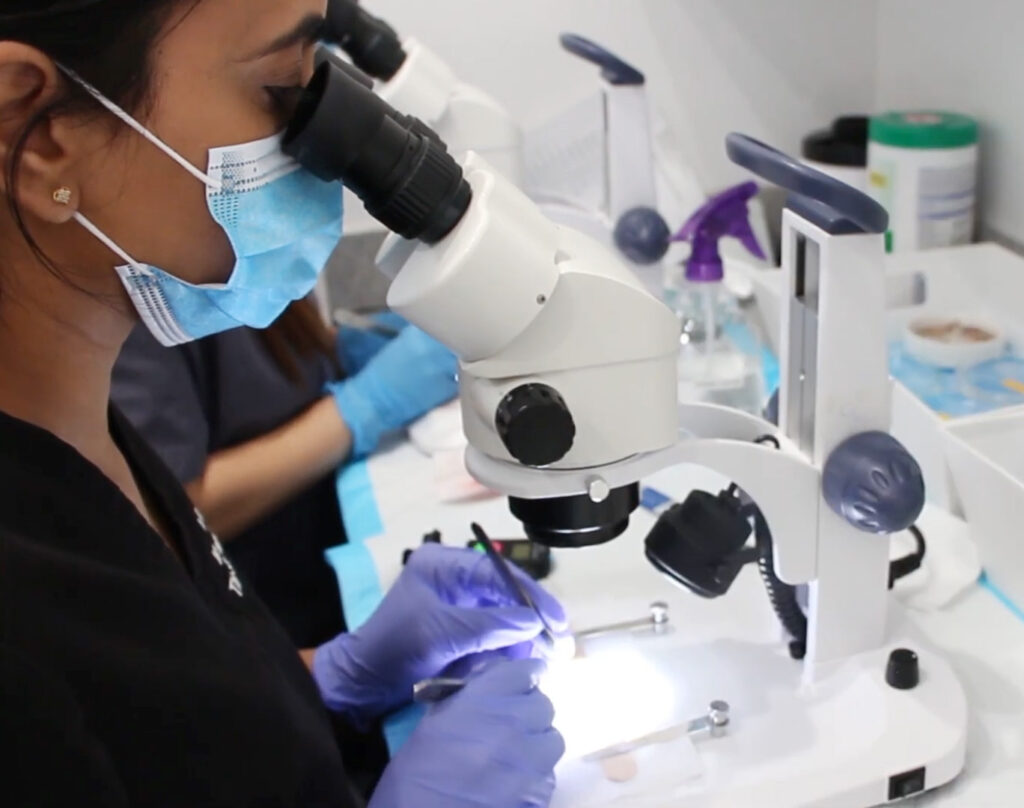 Hair transplant technicians checking hair grafts