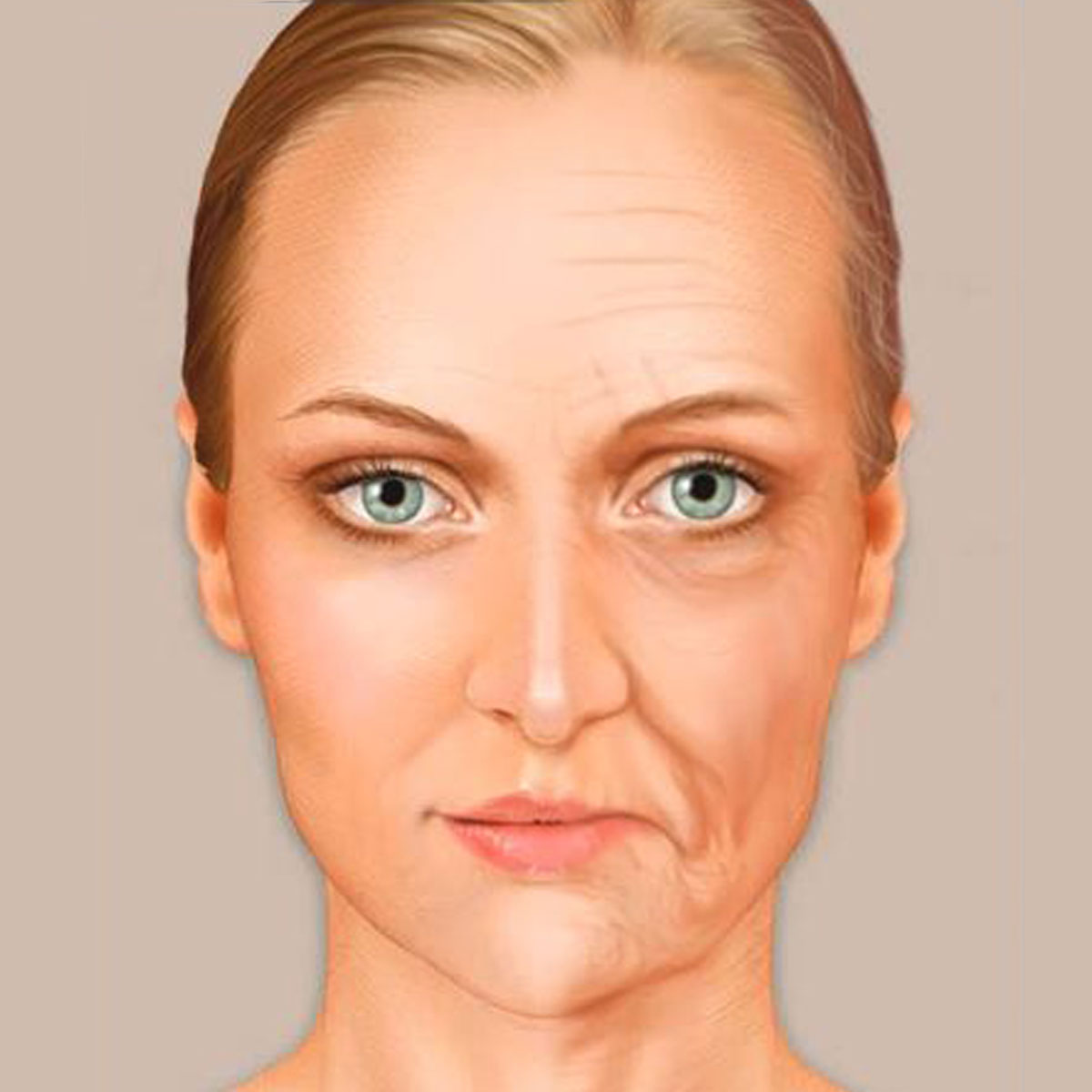 SIgns of facial aging