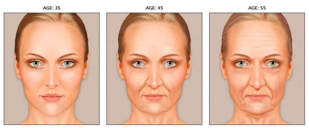 facial aging