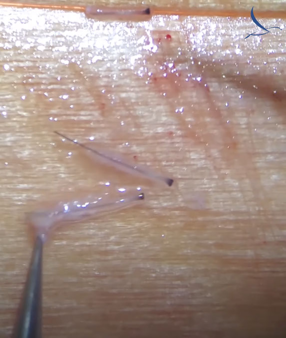 multi cut graft