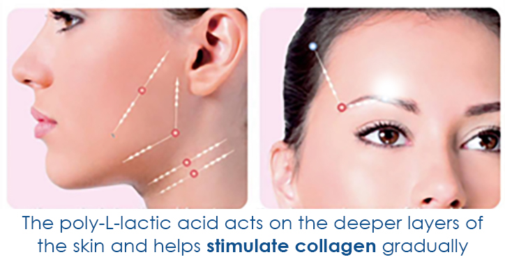 silhouette soft stimulating collagen