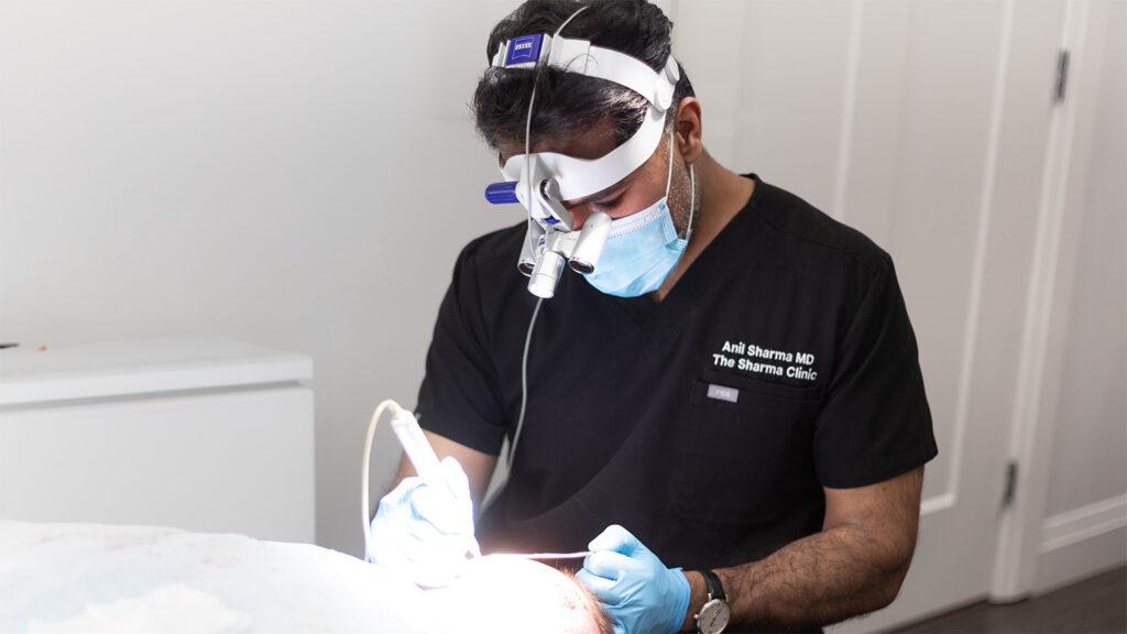 Doctor sharma performing hair transplant FUE procedure